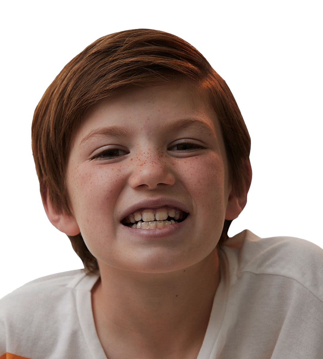 Se utilizan placas alineadoras, removibles y transparentes que alinean los dientes de manera progresiva.